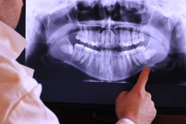 Best Emergency Dental Care for Abscessed Tooth in Mdleton, ID